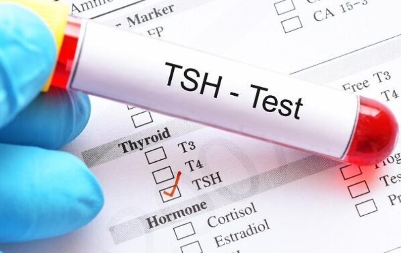 Анализ на ТТГ (тиреотропный гормон)