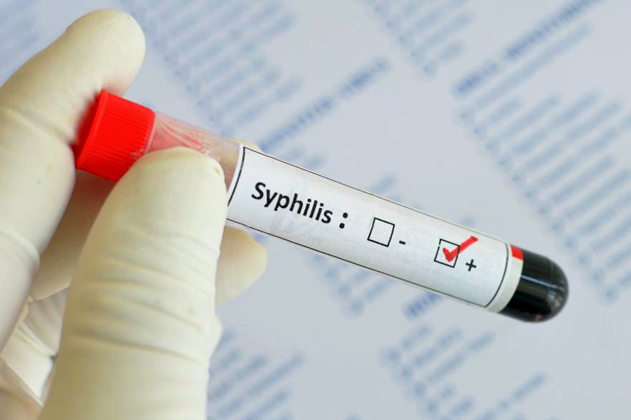 Сифилис — симптомы, диагностика, лечение, профилактика