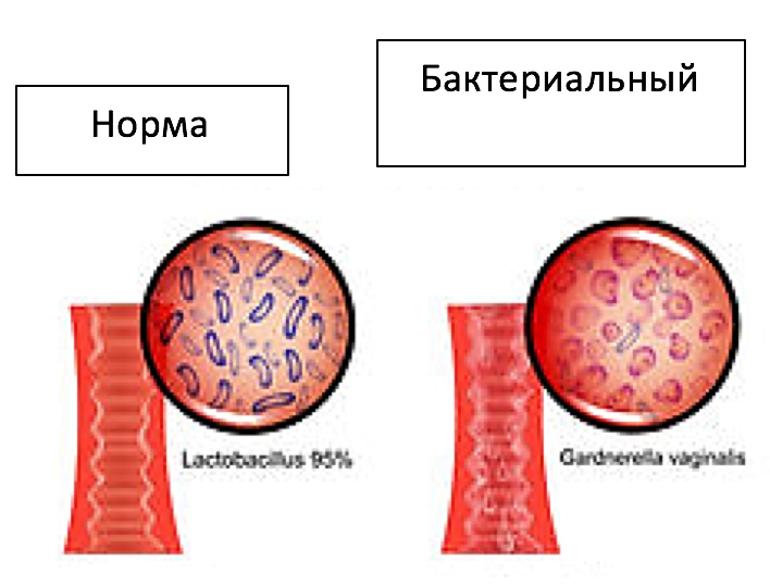 bakterioskopicheskie-issledovaniya-6.png