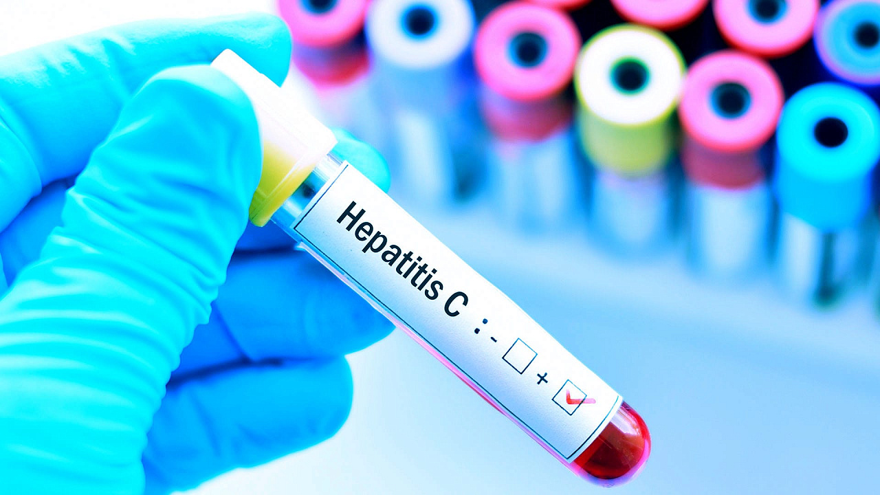 Гепатит С. Рекомендации ВОЗ 2016 года