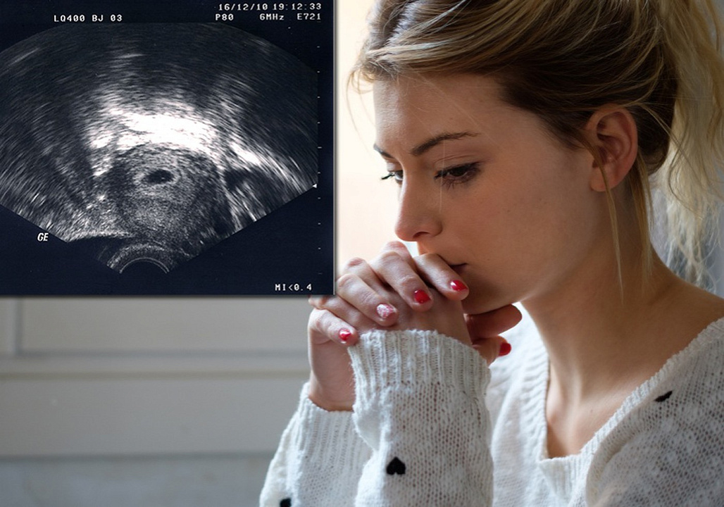 Аборт (прерывание беременности)