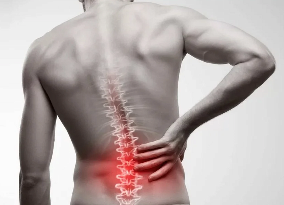 Боли в спине: причины и методы лечения