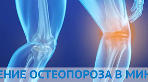 Диагностика и лечение остеопороза