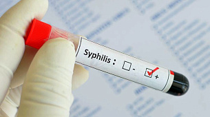 Сифилис — симптомы, диагностика, лечение, профилактика