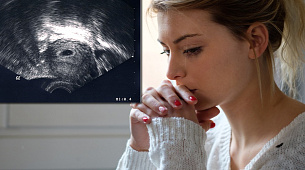 Аборт (прерывание беременности)