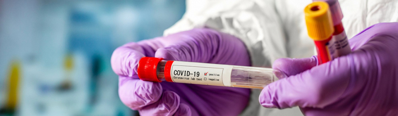 Тест на коронавирус (Covid-19)