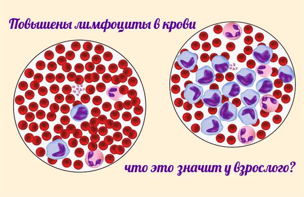 Что означает повышение лимфоцитов в крови
