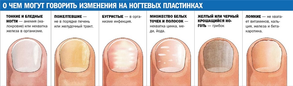 лечение ломкости ногтевой пластины в Москве